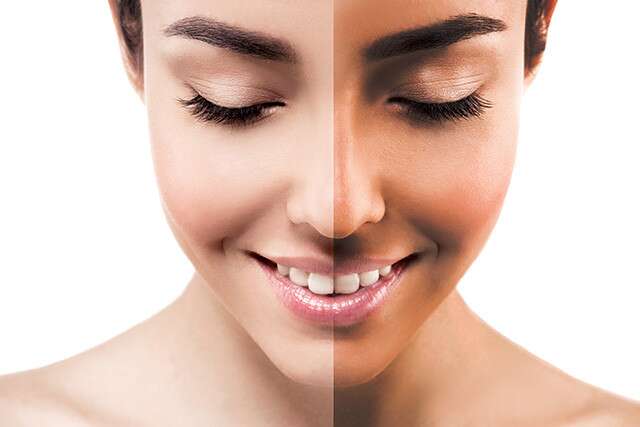 Tan Removal